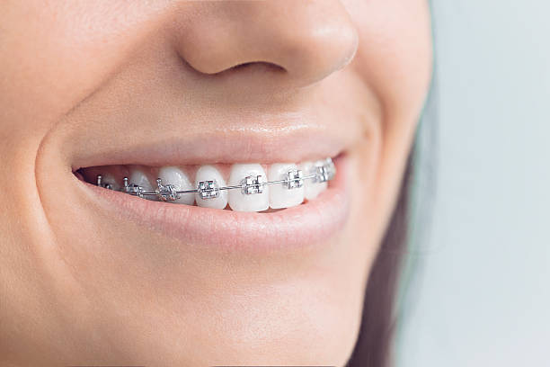 Best Wisdom Tooth Removal  in Blakely, GA